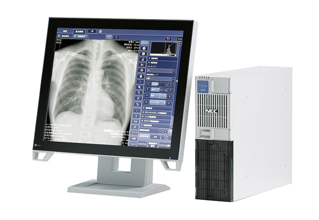 AI読影支援（EIRL Chest Screening）
